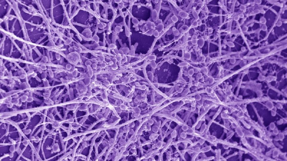 Η Candida Albicans Στο Μικροσκόπιο- Η Δίαιτα Και Τα Διατροφικά Συμπληρώματα Κατά Του Μύκητα